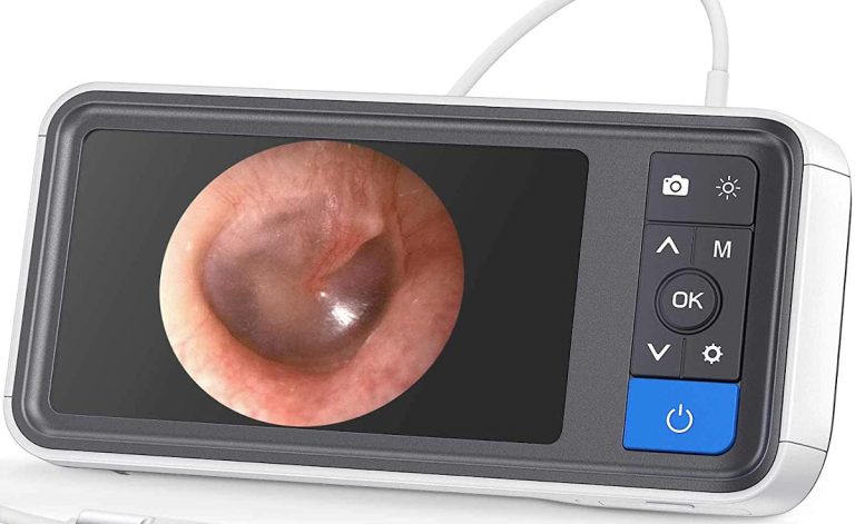 Top 5 Best Digital Otoscope